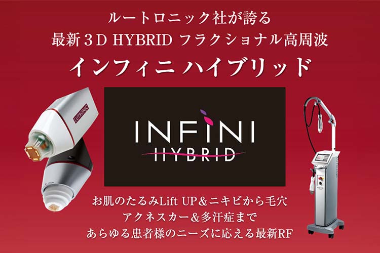 インフィニ ハイブリッド