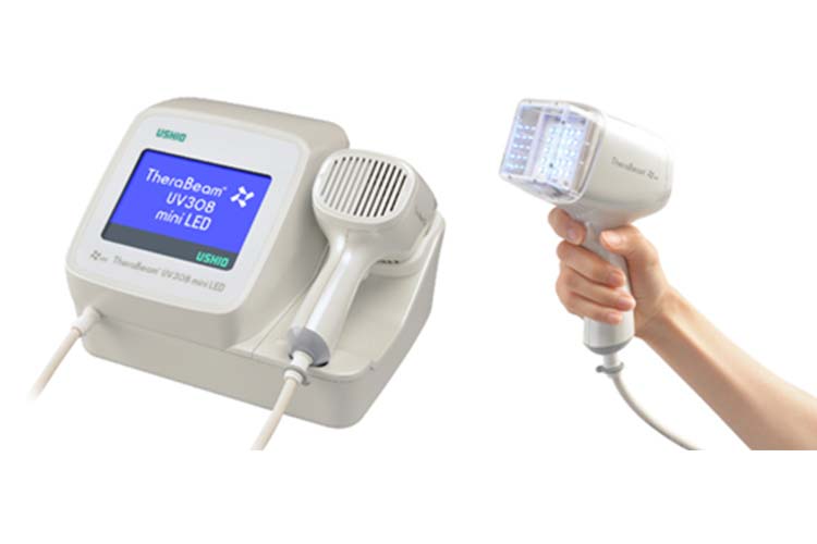 新型エキシマライト(セラビームUV308mini LED)による光線療法